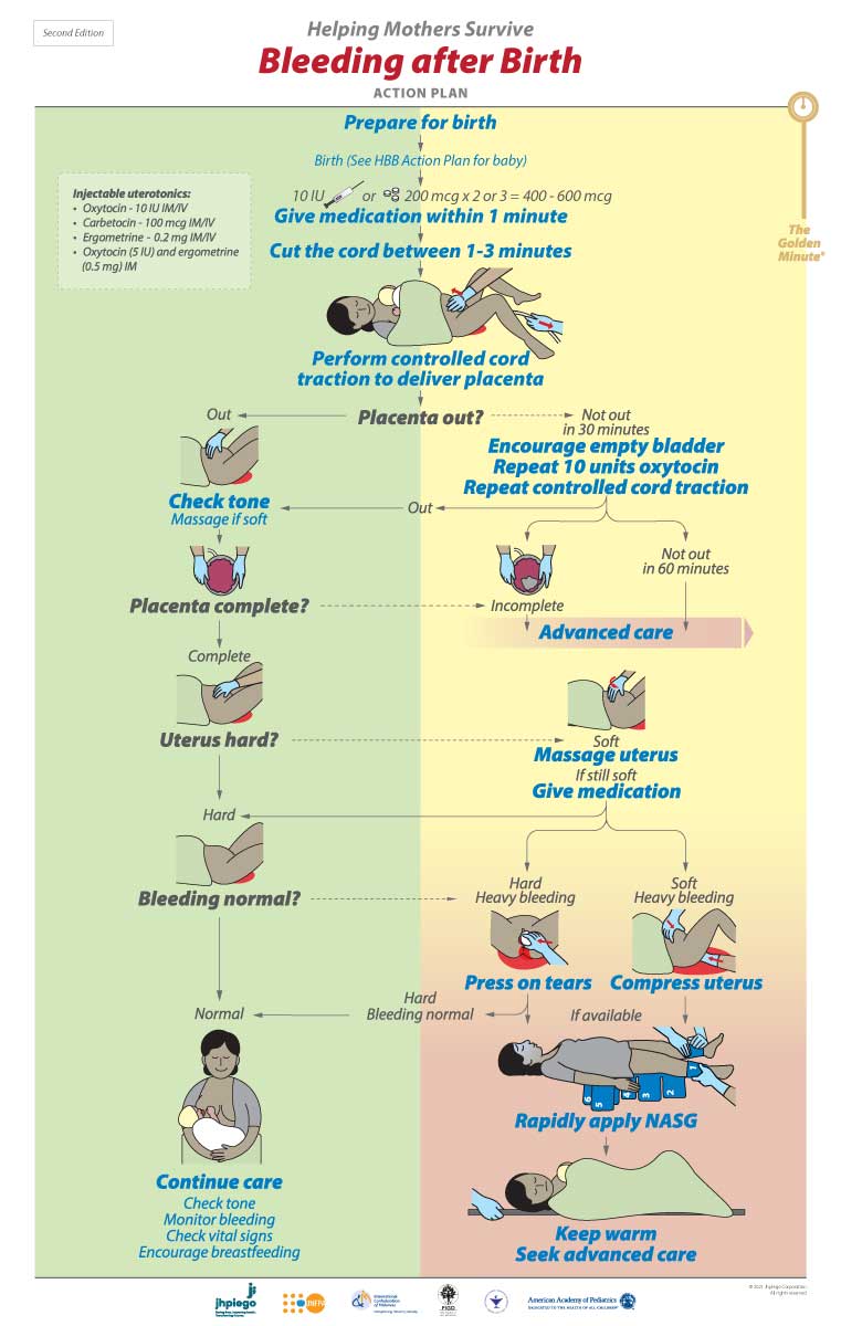 Bleeding After Birth Complete - Helping Mothers And Babies Survive